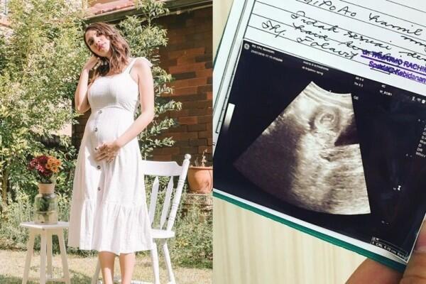 Makin Anggun dan Memesona, Ini 10 Potret Acha Sinaga dengan Baby Bump