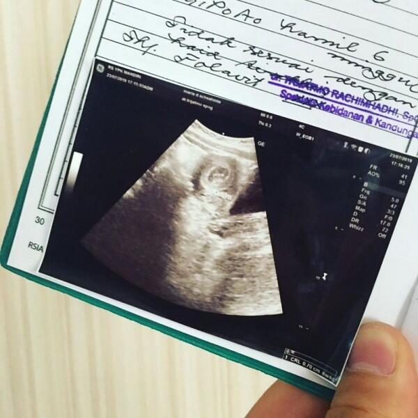 Makin Anggun dan Memesona, Ini 10 Potret Acha Sinaga dengan Baby Bump