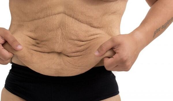 Menurunkan Berat Badan dengan Cepat Itu Tidak Sehat, Ketahui Alasannya