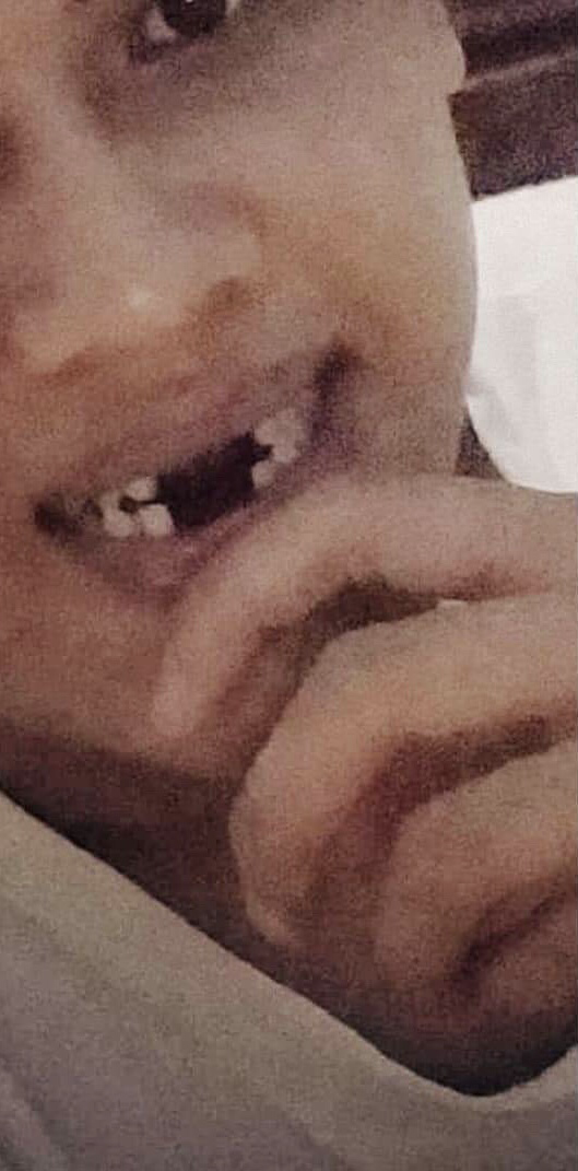 Pongah (Ompong Tengah)