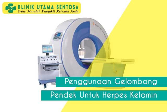 Penggunaan Gelombang Pendek untuk Herpes Kelamin