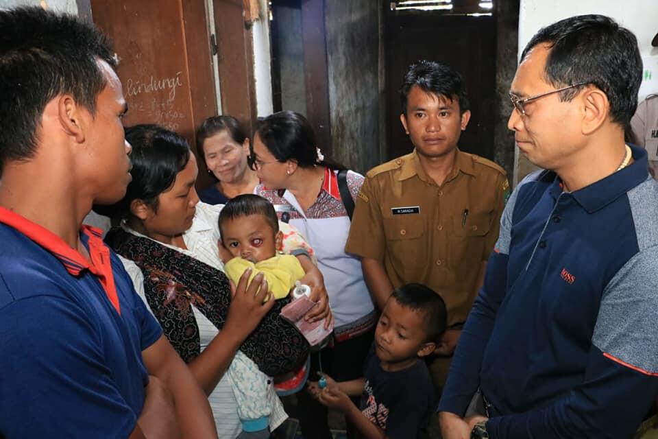 Merasa Prihatin, Bupati Simalungun Bantu Perobatan Daud Gultom Warga Tiga Bolon