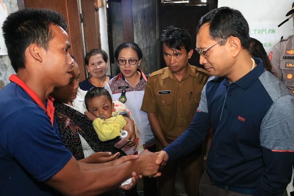 Merasa Prihatin, Bupati Simalungun Bantu Perobatan Daud Gultom Warga Tiga Bolon