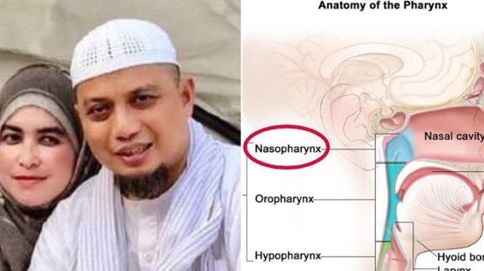 Ini lo Kanker Nasofaring yang Menyebabkan Ustaz Arifin Ilham Meninggal dunia