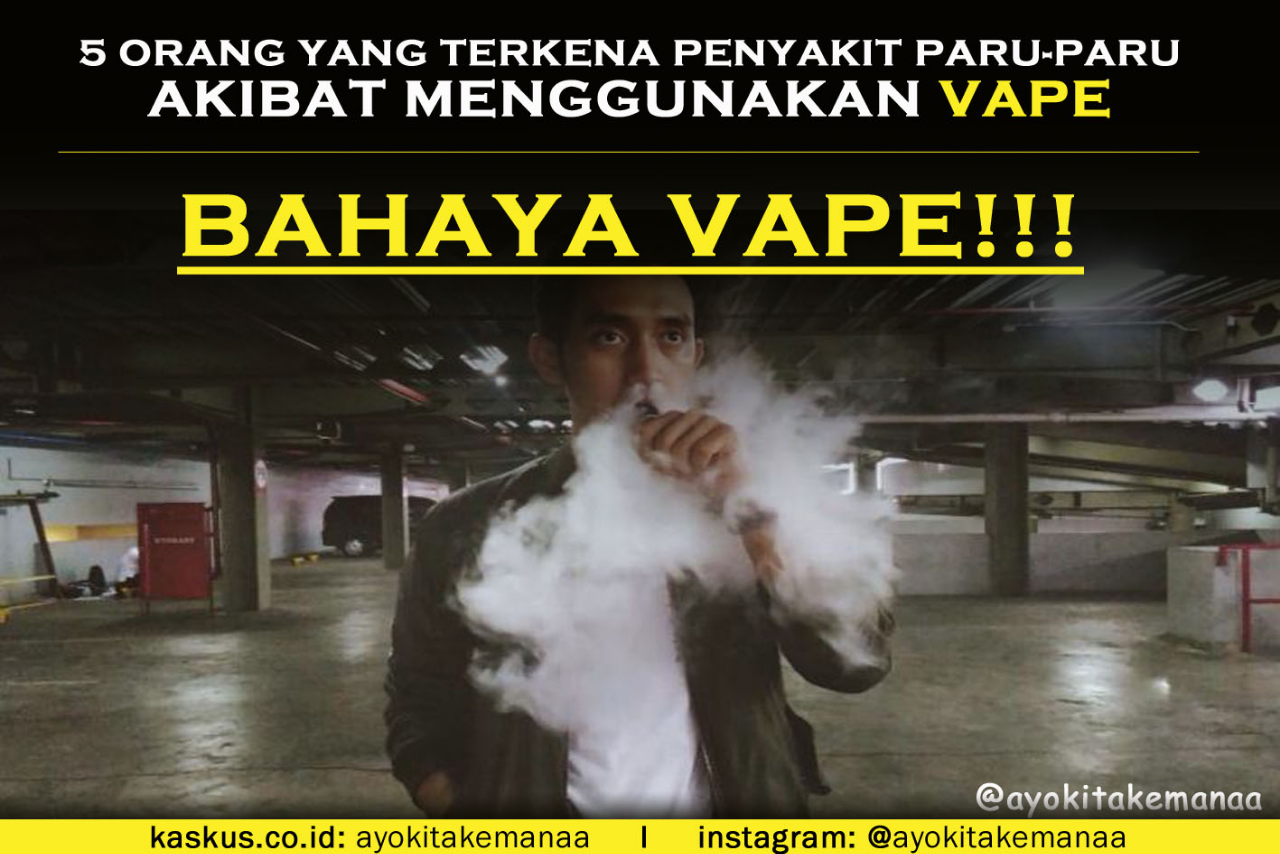 Bukti Bahayanya Vape! 5 Orang Ini Terkena Penyakit Paru-Paru Akibat Menggunakan Vape!