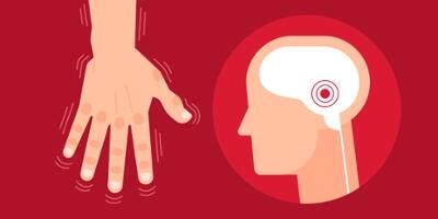 TREMOR, SEKEDAR KEBIASAAN ATAU MEMBAHAYAKAN?