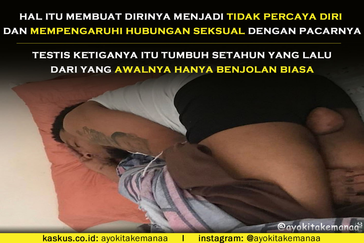 Merasa Tidak PD Saat Having Sex Dan Beraktivitas, Pria Ini Operasi Testis Ketiganya