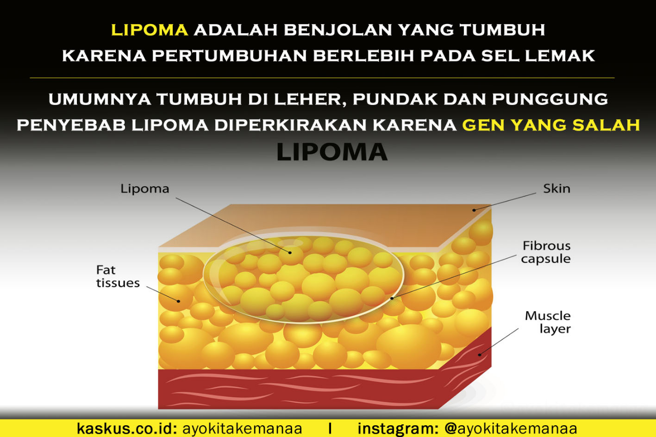 Merasa Tidak PD Saat Having Sex Dan Beraktivitas, Pria Ini Operasi Testis Ketiganya