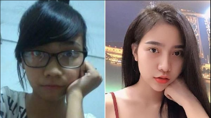 Perempuan Tak Dikenal Keluarga Setelah Menjalankan Operasi Plastik