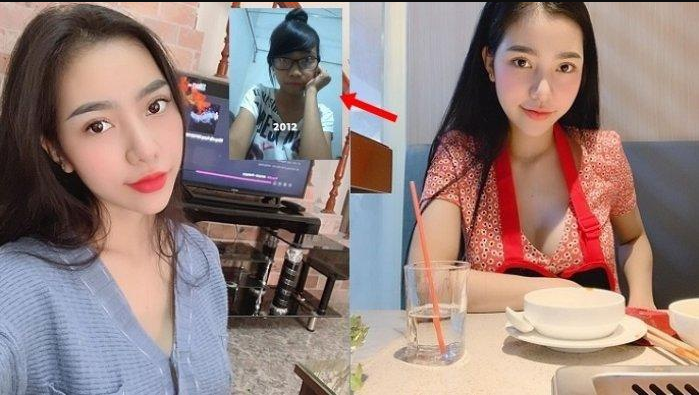 Perempuan Tak Dikenal Keluarga Setelah Menjalankan Operasi Plastik