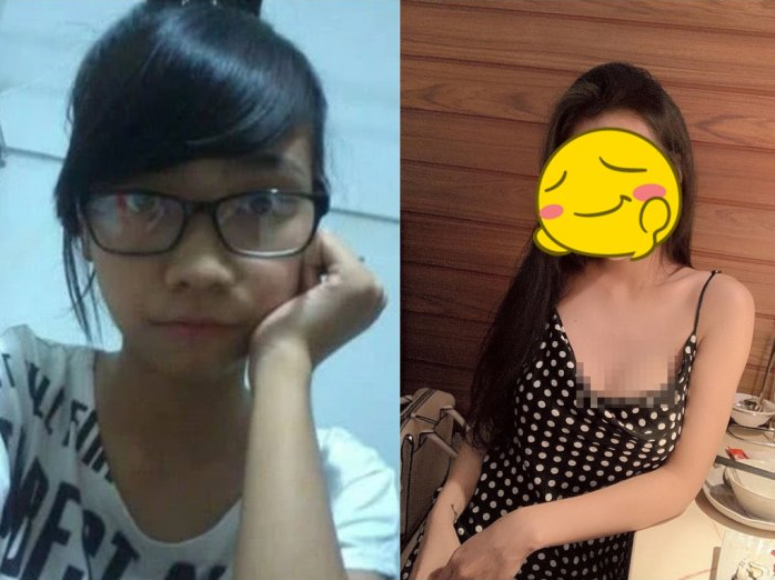 Perempuan Tak Dikenal Keluarga Setelah Menjalankan Operasi Plastik