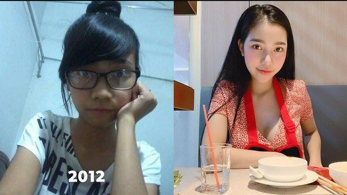 Perempuan Tak Dikenal Keluarga Setelah Menjalankan Operasi Plastik