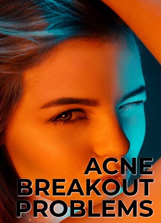 Cara Mudah Atasi Breakout Pada Wajah