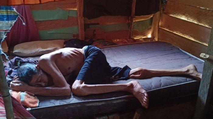 Kek Bandung Menahun Sakit di Aceh , Tolak Dikasihani dan Arahkan Bantuan untuk Masjid