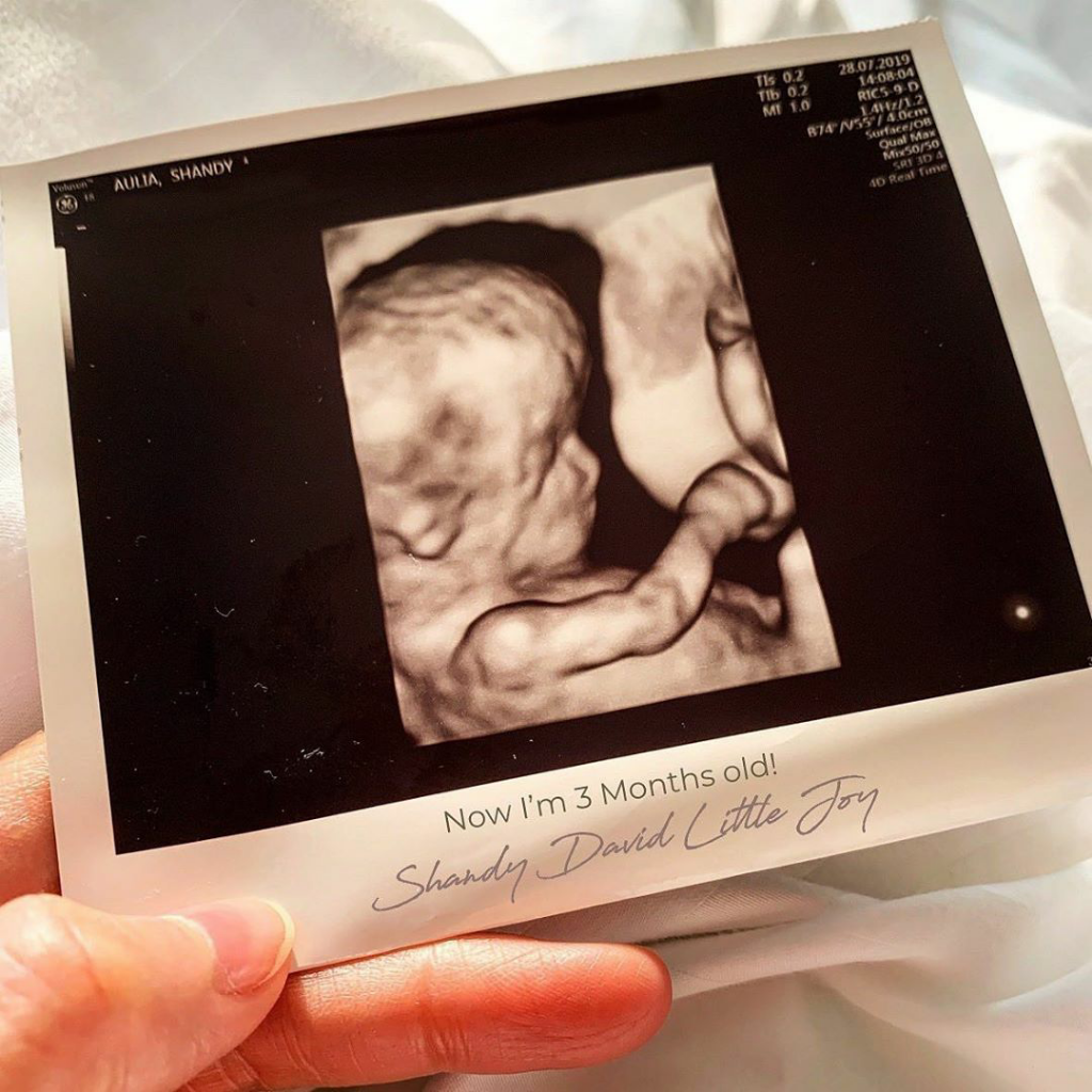 Hamil, Shandy Aulia Tetap Cantik Dengan Perutnya Yang Semakin Membuncit!