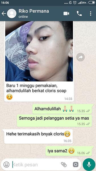 Agen Produk Perawatan Pria CLORISMEN Cocok Untuk Anak Muda SMA Kuliah Karyawan