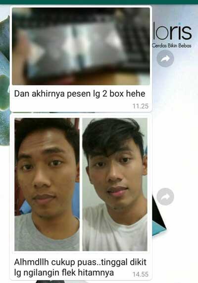 Agen Produk Perawatan Pria CLORISMEN Cocok Untuk Anak Muda SMA Kuliah Karyawan
