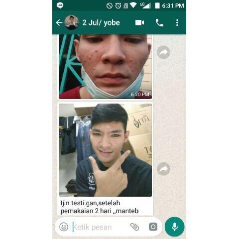 Agen Produk Perawatan Pria CLORISMEN Cocok Untuk Anak Muda SMA Kuliah Karyawan