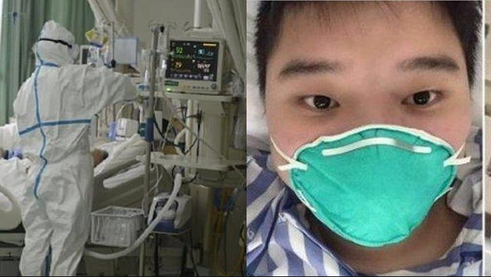 Orang Pertama Sembuh Dari Corona Virus, Sempat Kritis