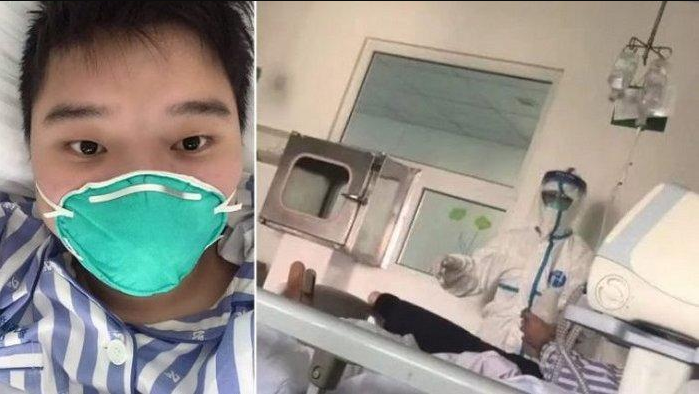 Orang Pertama Sembuh Dari Corona Virus, Sempat Kritis