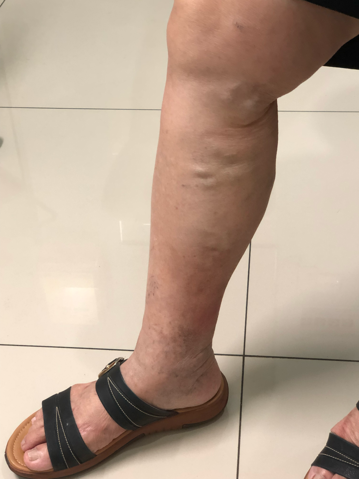 Siapa varises?