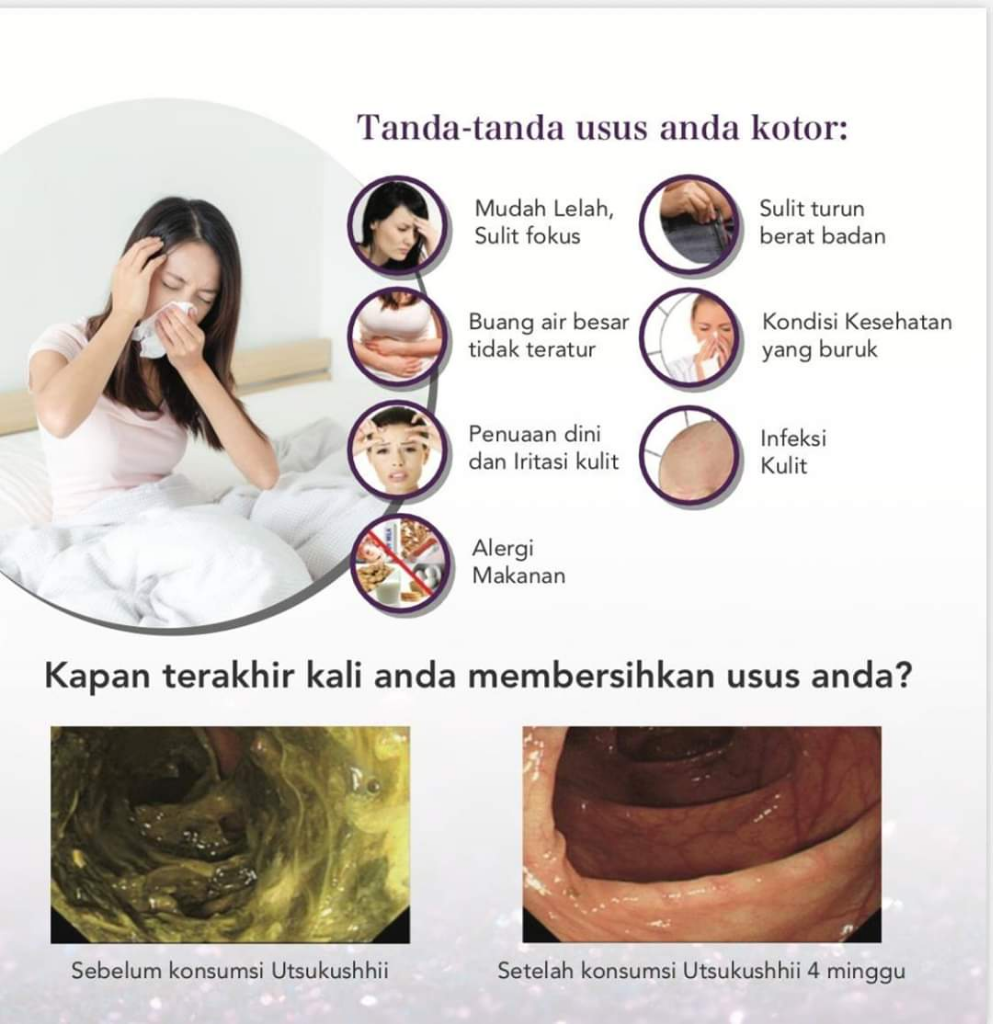 MARKETING PLAN AFC LIFE SCIENCE NETWORK - AFC WINNING TEAM 🇯🇵🇮🇩 +62852.7755.3117