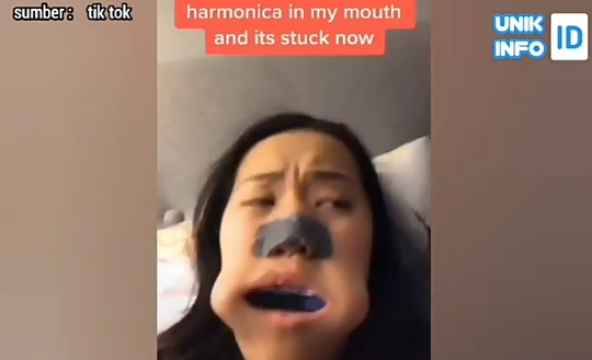 Harmonika Nyangkut di Dalam Mulut karena Main Tik Tok, Wanita ini Kebingungan! 