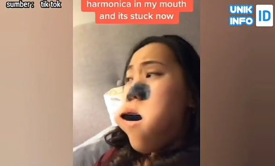 Harmonika Nyangkut di Dalam Mulut karena Main Tik Tok, Wanita ini Kebingungan! 