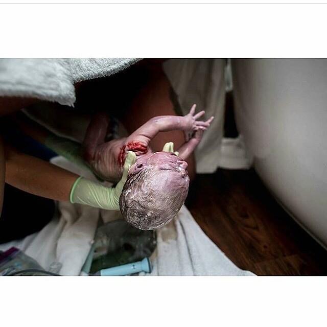 Momen Melahirkan, Buat Sebagian Orang Menangis Dan Tak Ingin Jadi Anak Durhaka!