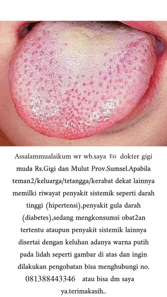 &#91;HELP/URGENT&#93; DICARI CALO DAN PASIEN KOAS GIGI PALEMBANG