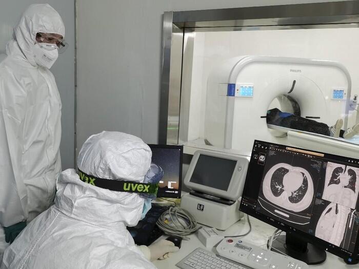 &#91;BAHAYA&#93; Ubah Diagnosis, Jumlah Kasus Virus Corona Cina Melonjak, Indonesia ??