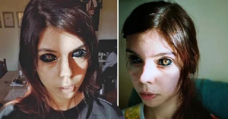 Demi Tiru Idola, Wanita Ini Buta Akibat Mentato Bola Matanya