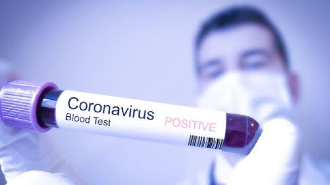 Darurat Virus Corona