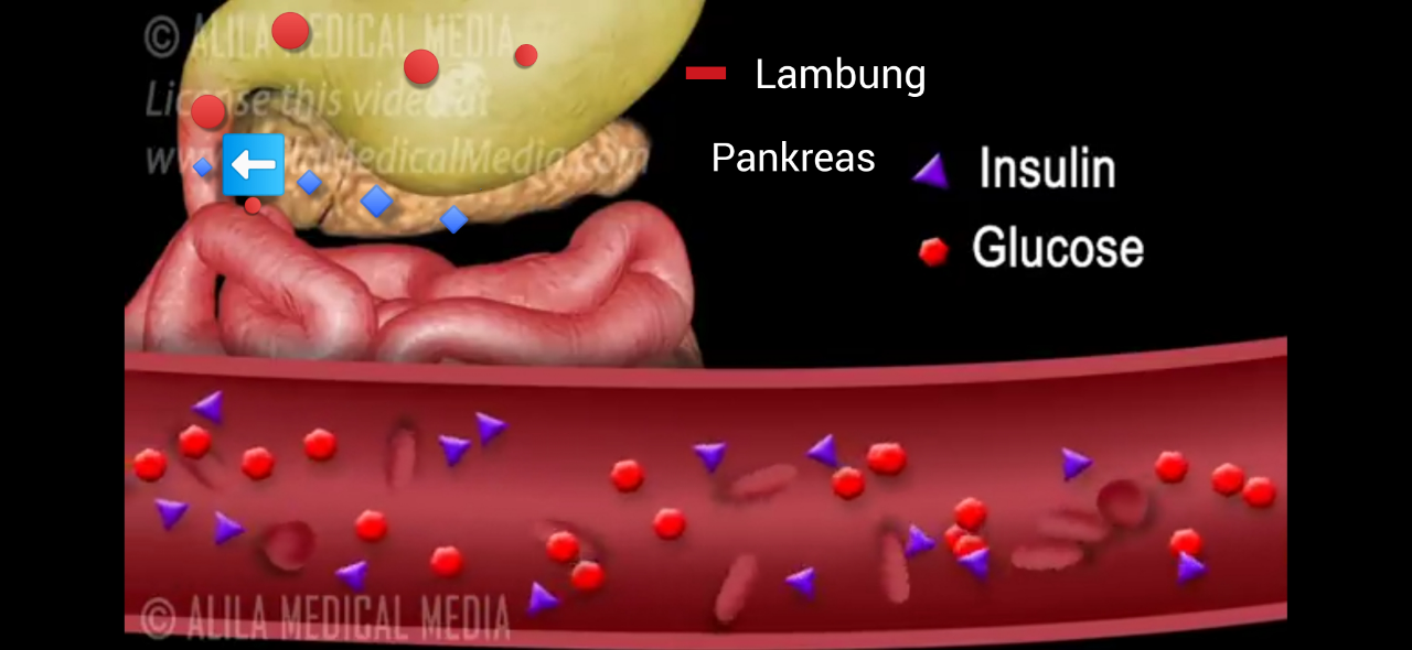 Apakah Diabetes Basah Dan Kering itu Ada??