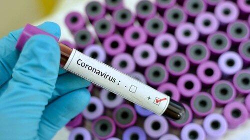 Stop Berita Hoaks Bijak Gunakan Media Sosial Soal Corona