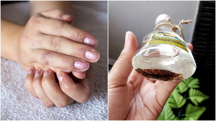 Penggunaan Hand Sanitizer Bikin Kulit Tanganmu Kering? Lakukan Ini Aja, Sis!