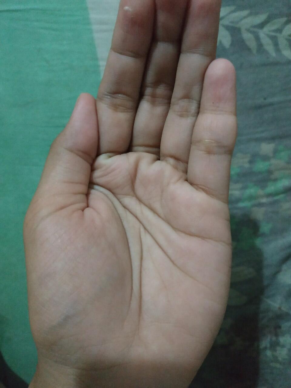 Garis