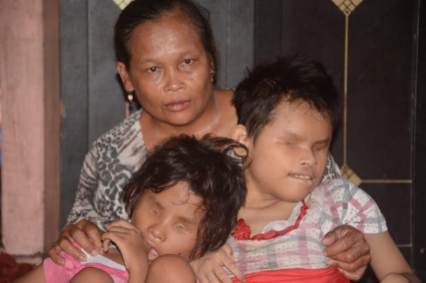 Derita Kakak Adik Buta sejak Lahir, Tak Bisa Berjalan dan Telat Makan Tiap Hari