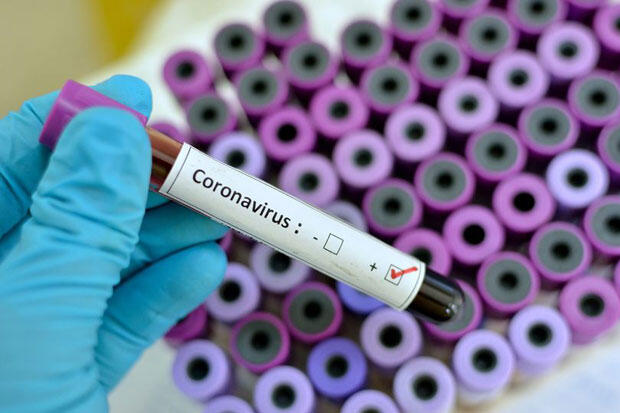 Kasus Positif Virus Corona Menjadi 514, Tersebar di 20 Provinsi