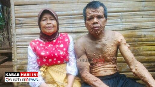 Berharap Sembuh, Si Penjual Kayu Bakar ini Butuh Uluran Dermawan dan Pemerintah