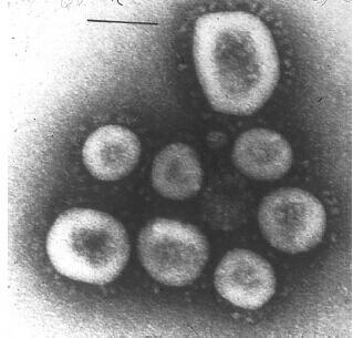 Sejarah Singkat Virus Corona
