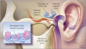 Mengenal Tinnitus