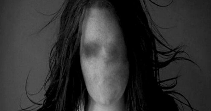 Sosok Perempuan Tanpa Wajah Yang Kutemui Di Taman Maluku Bandung...