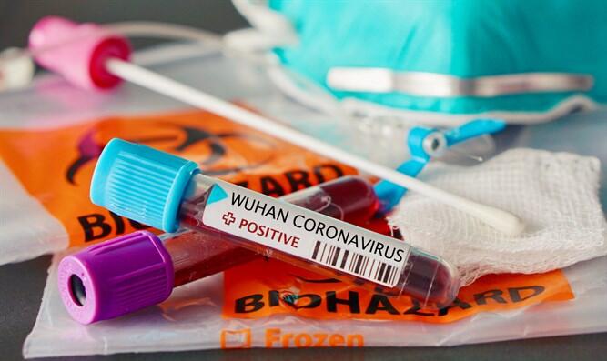 Bukan Virus Corona, Flu Spanyol Merupakan Pandemi Paling Mematikan dalam Sejarah