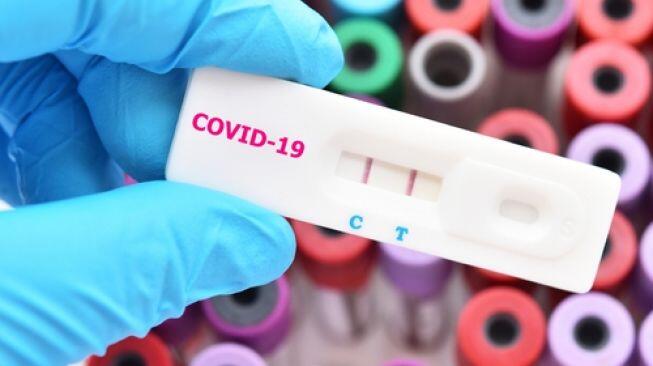 18.077 Orang di Jakarta Rapid Test, 299 Positif Corona