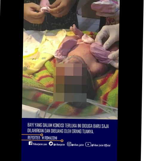 Ibu Kandung Tega Melempar Bayinya Yang Baru Lahir Ke Atap Rumah