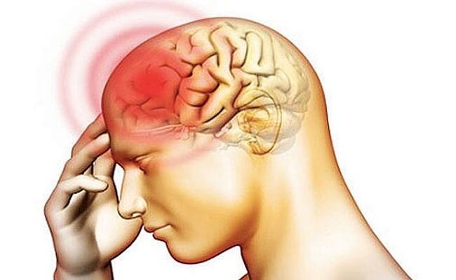 Mengenal Meningitis, Penyakit Glen Fredly yang Serupa Dengan Olga Syahputra