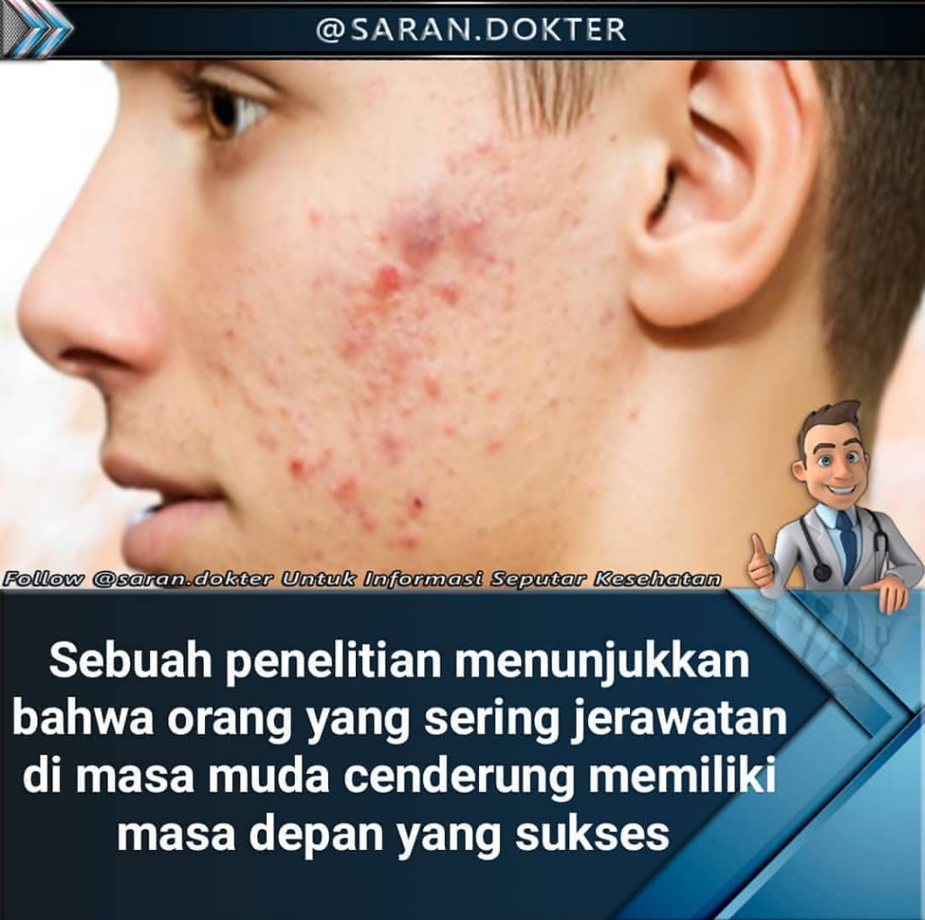 Keterkaitan Jerawat Dengan Performa Kesuksesan Sesorang