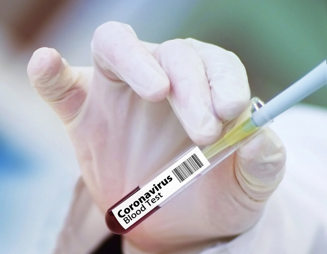 Ilmuwan temukan obat baru untuk pasien COVID-19