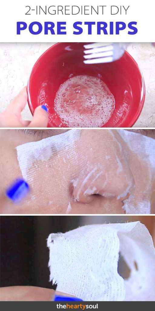 Putih Telur+tisu Bisa Bantu Angkat Komedo? Bisa Banget! 